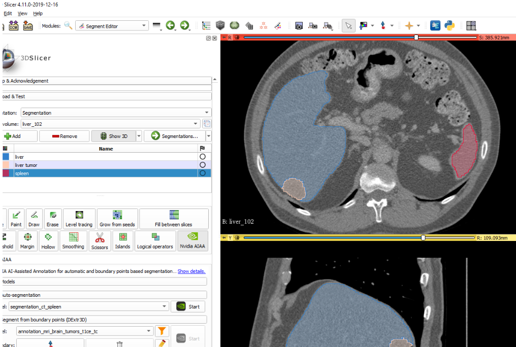 3D Slicer screenshot